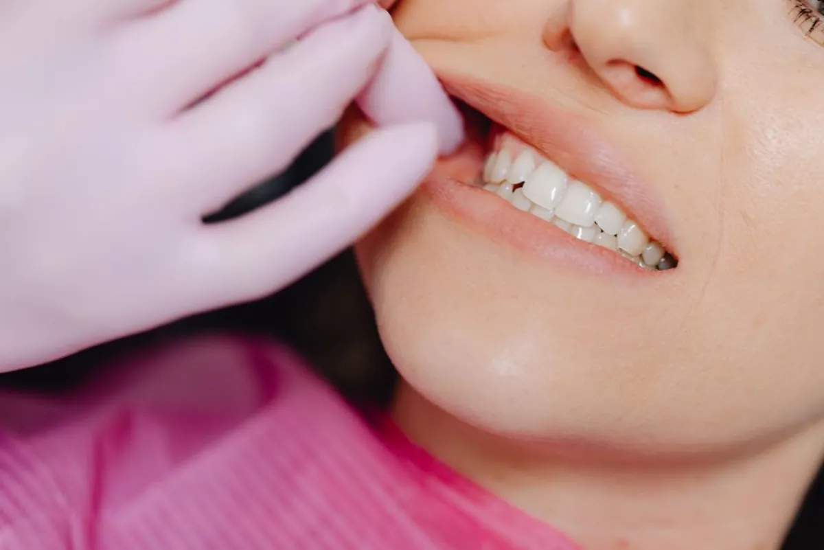 front teeth